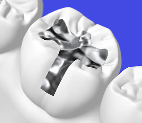 福岡県久留米市野中町・くろいわ総合歯科クリニック・金属