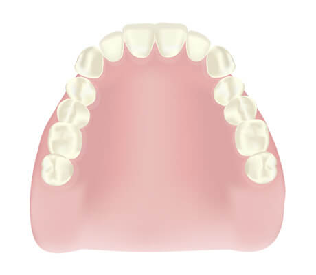 福岡県久留米市野中町・くろいわ総合歯科クリニック・シリコンデンチャー